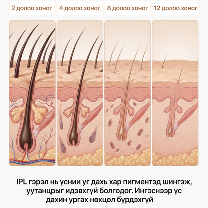 BelleSkin IPL Төхөөрөмж